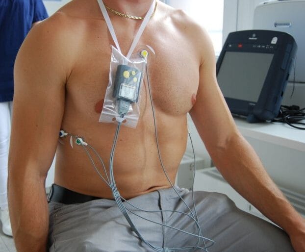 Holter ECG Holter ECG