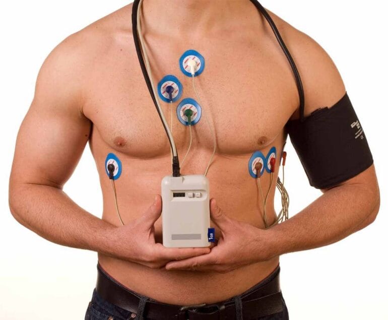 Holter Tensionnel (MAPA) Holter tensionnel (MAPA)
