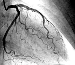 Interventions Image de Coronarographie - Dr Haddar Omar Cardiologue à Tanger
